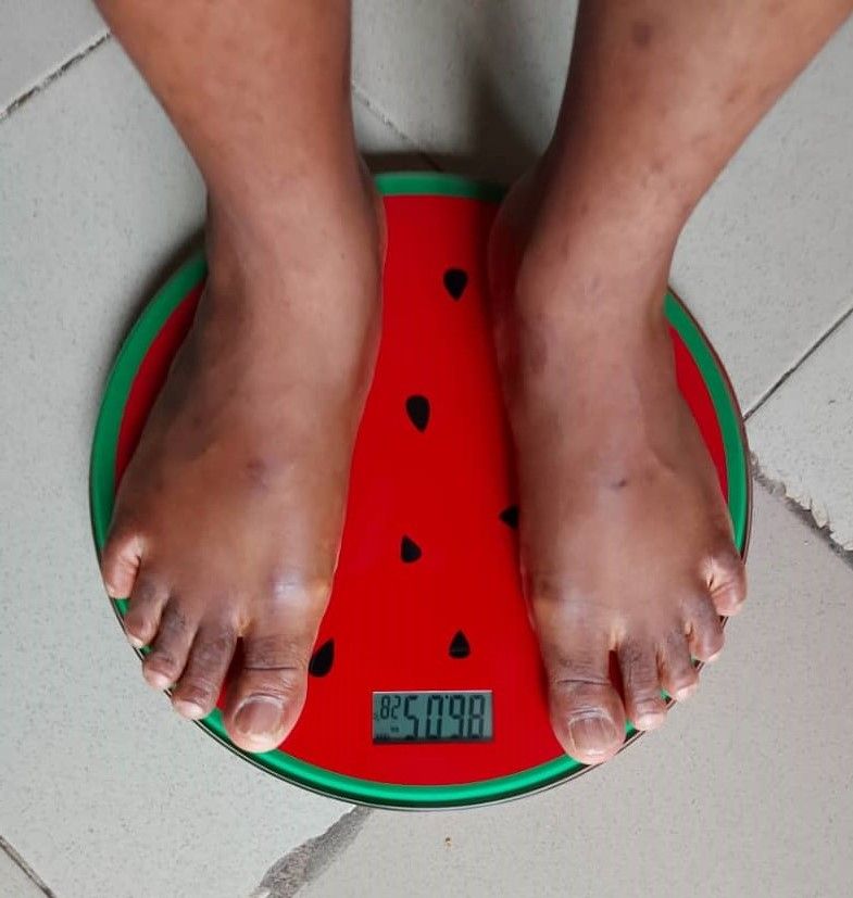 DIGITAL BODY SCALE - STEP ON TECHNOLOGY - WATERMELON DESIGN