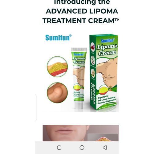 Sumifun Effective Lipoma Removal Cream/ Fat Lump Removal 2Pics