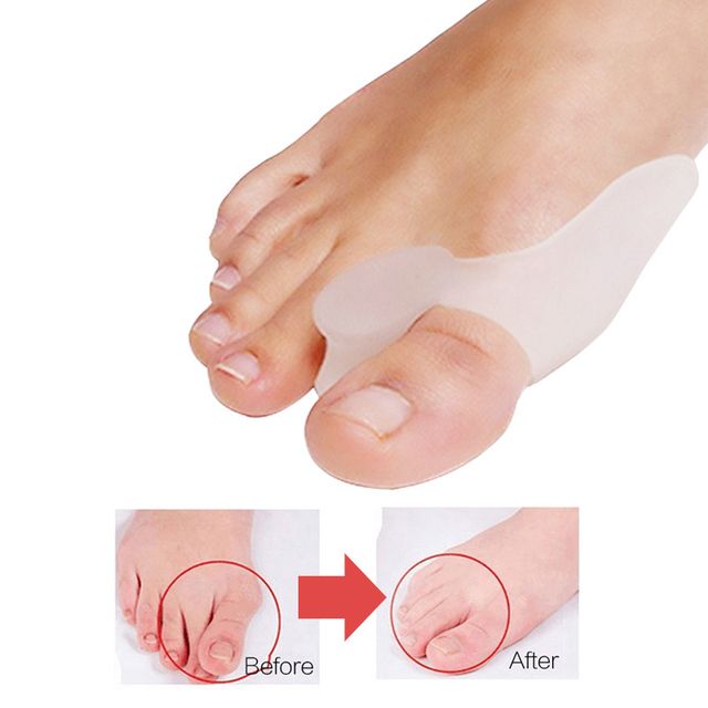 2Pcs 1Pair Hallux Valgus Bunion Corrector Silicone  Big Toes Separators Splint Feet Straightener Bone Thumb Foot Care Tools(#1Pair B13)