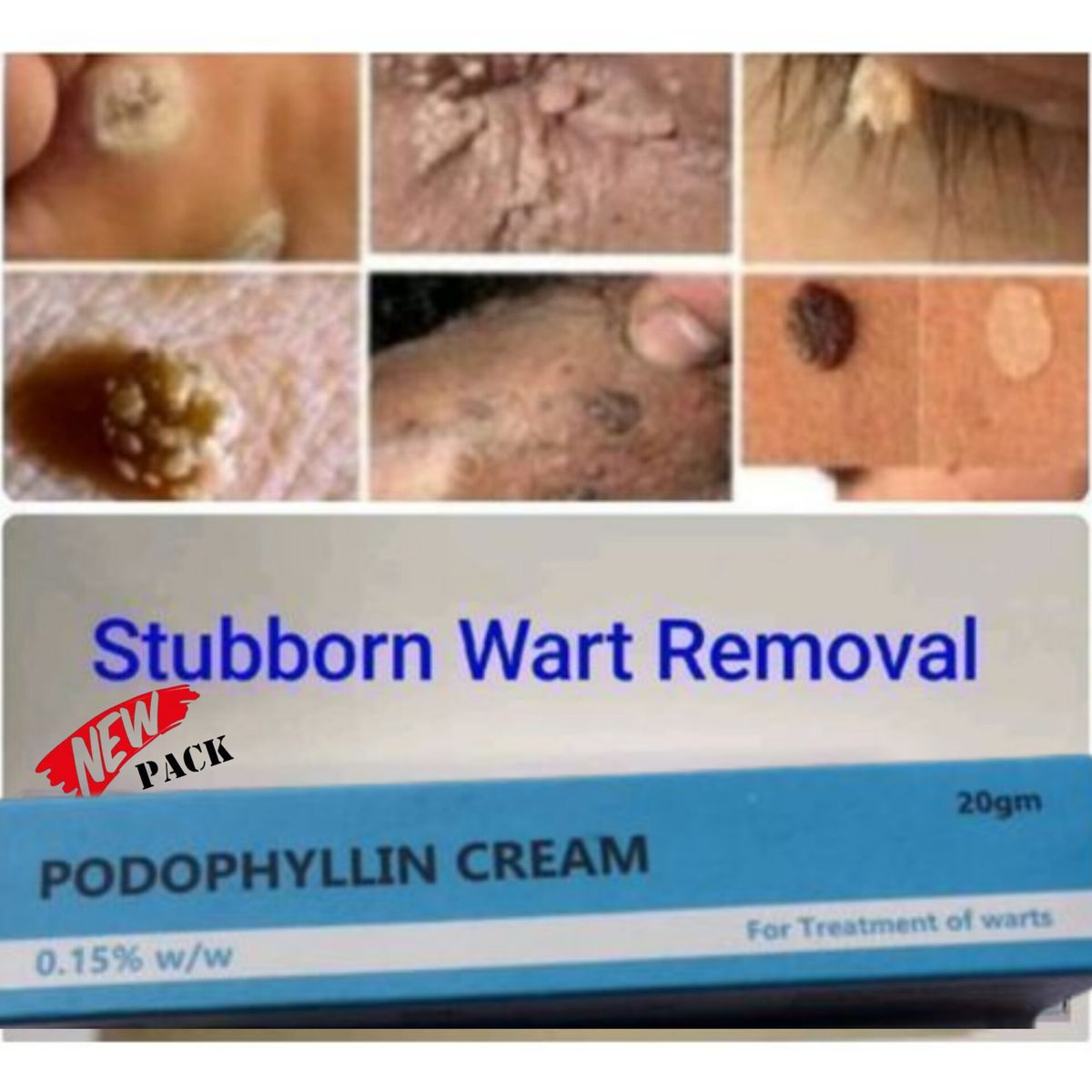 Podophyllin Cream For Skin Warts/Freckle/Spots/Tags
