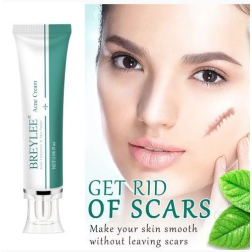 Keloids Scar Cream - Acne Scar Stretch Marks Remover Keloids Cream Skin Repair Face Cream Acne Spots Acne Treatment Blackhead Whitening Cream Skin Care