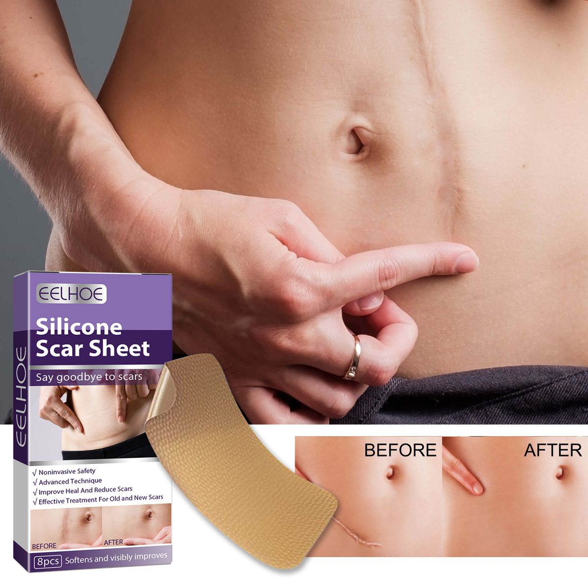 8Pcs Silicone Scar Sheets Safety Mild Odorless