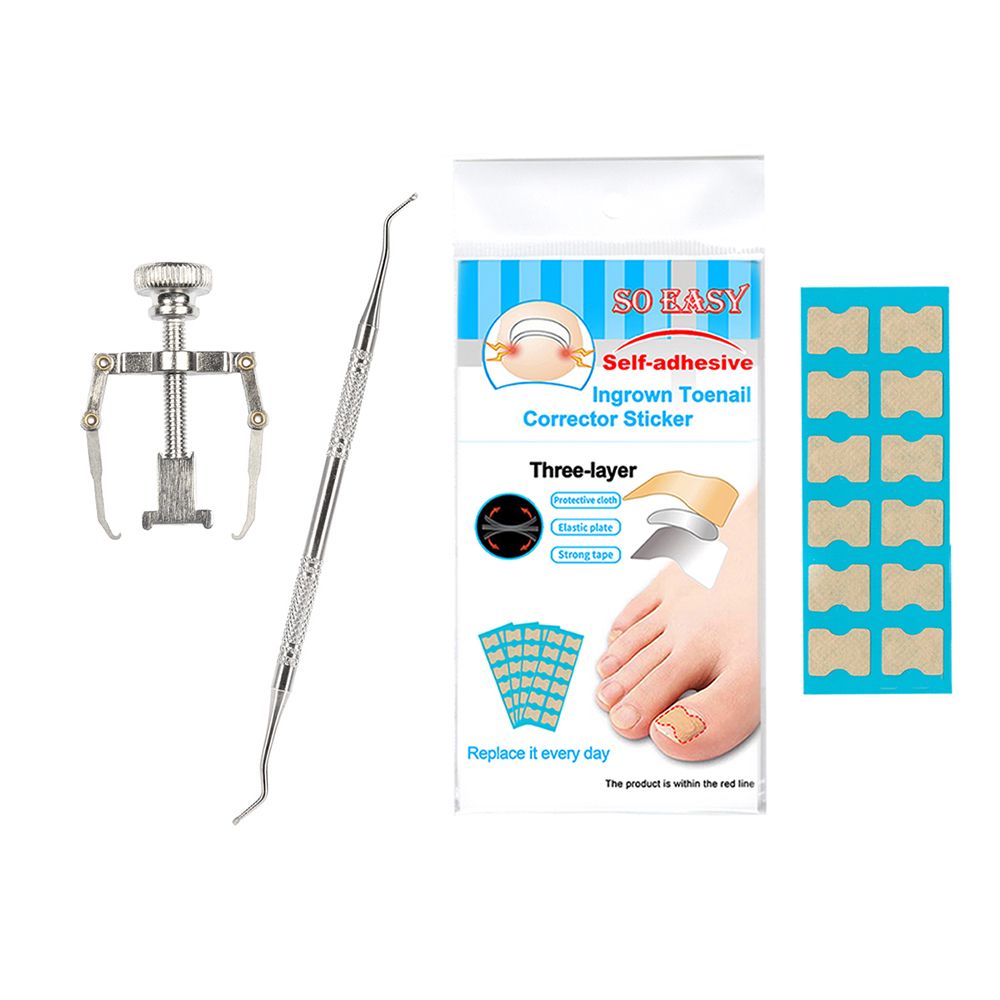 Ingrown Nail Correction Kit Ingrown Toenail Stickers Toe