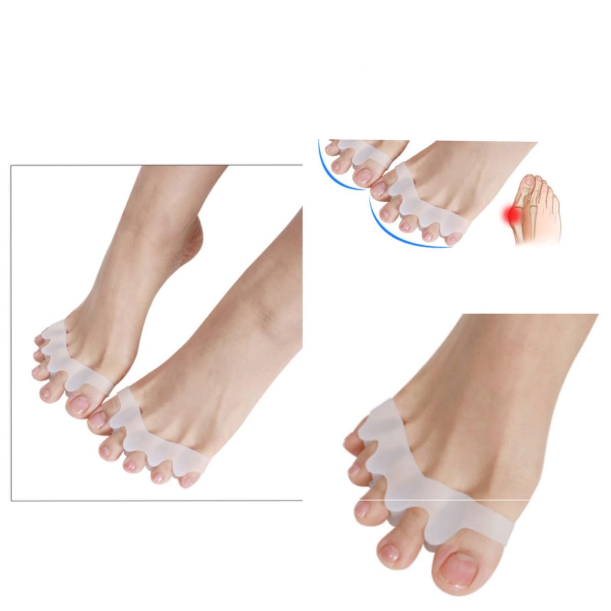 Big Toe Bunion Corrector Fraction Toe Straightener Hallux Valgus Straightener Bunion Toe Seperator
