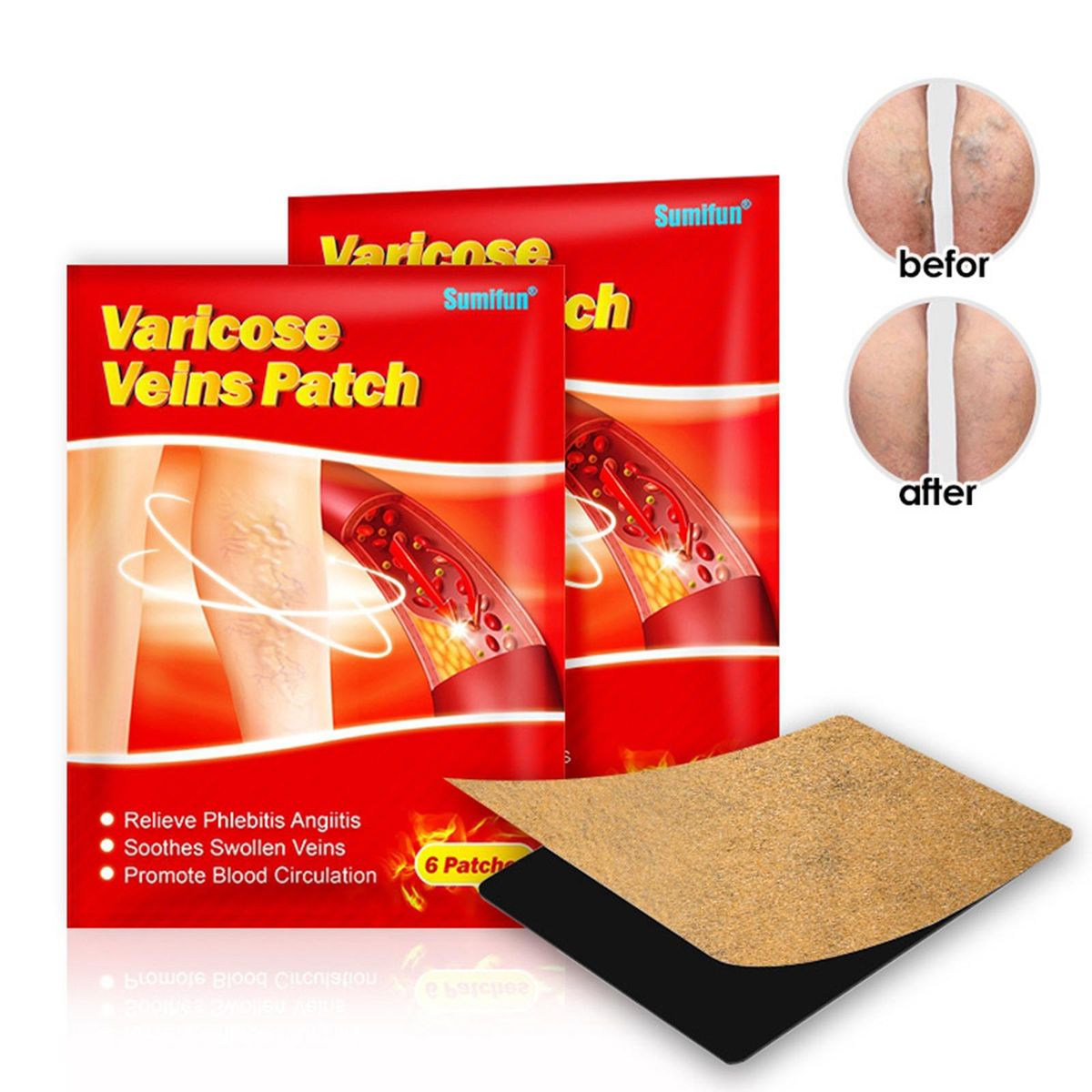 Chinese Varicose Veins Plaster Phlebitis Varicosity Back Leg Patch 7 X