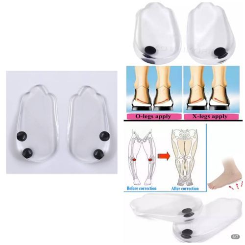 Magnetic Insole O/X Leg Type, Valgus Varus, Plantar Faciitis Corrector