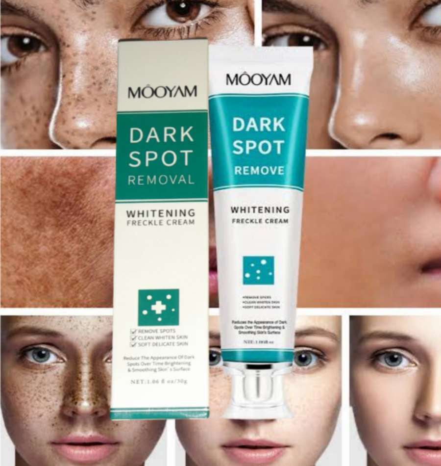 Dark Spot Removal Whitening Freckle Cream 30g