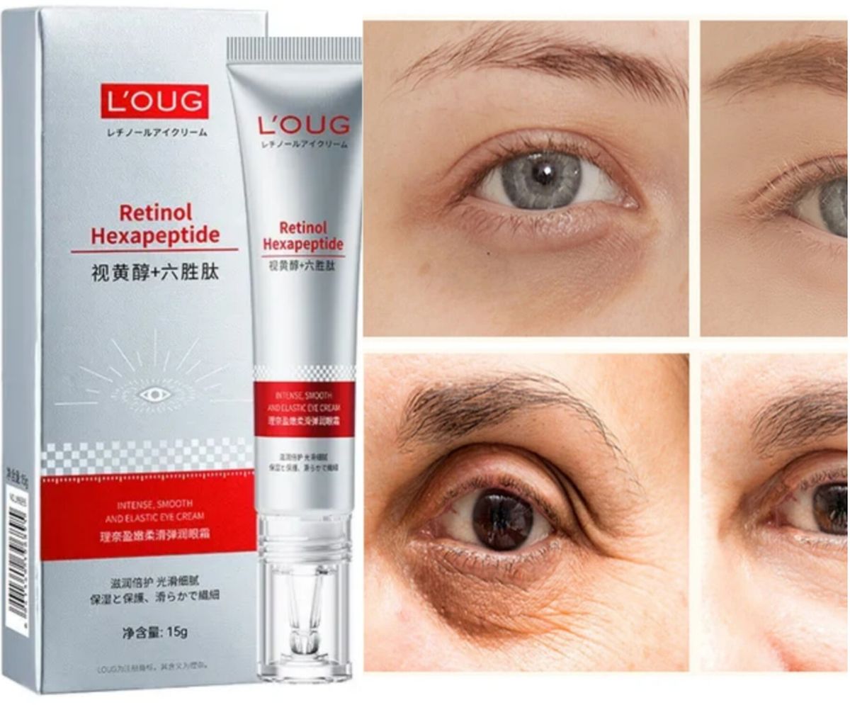 Retinol  Anti Wrinkles, Anti Aging & Dark Circles  Removal  Eye Cream