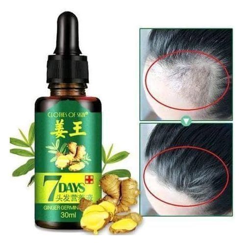 7 Days Ginger Germinal Hair Growth Oil