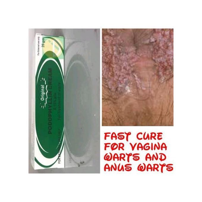 Podophyllin Cream For Skin Warts/Freckle/Spots/Tags