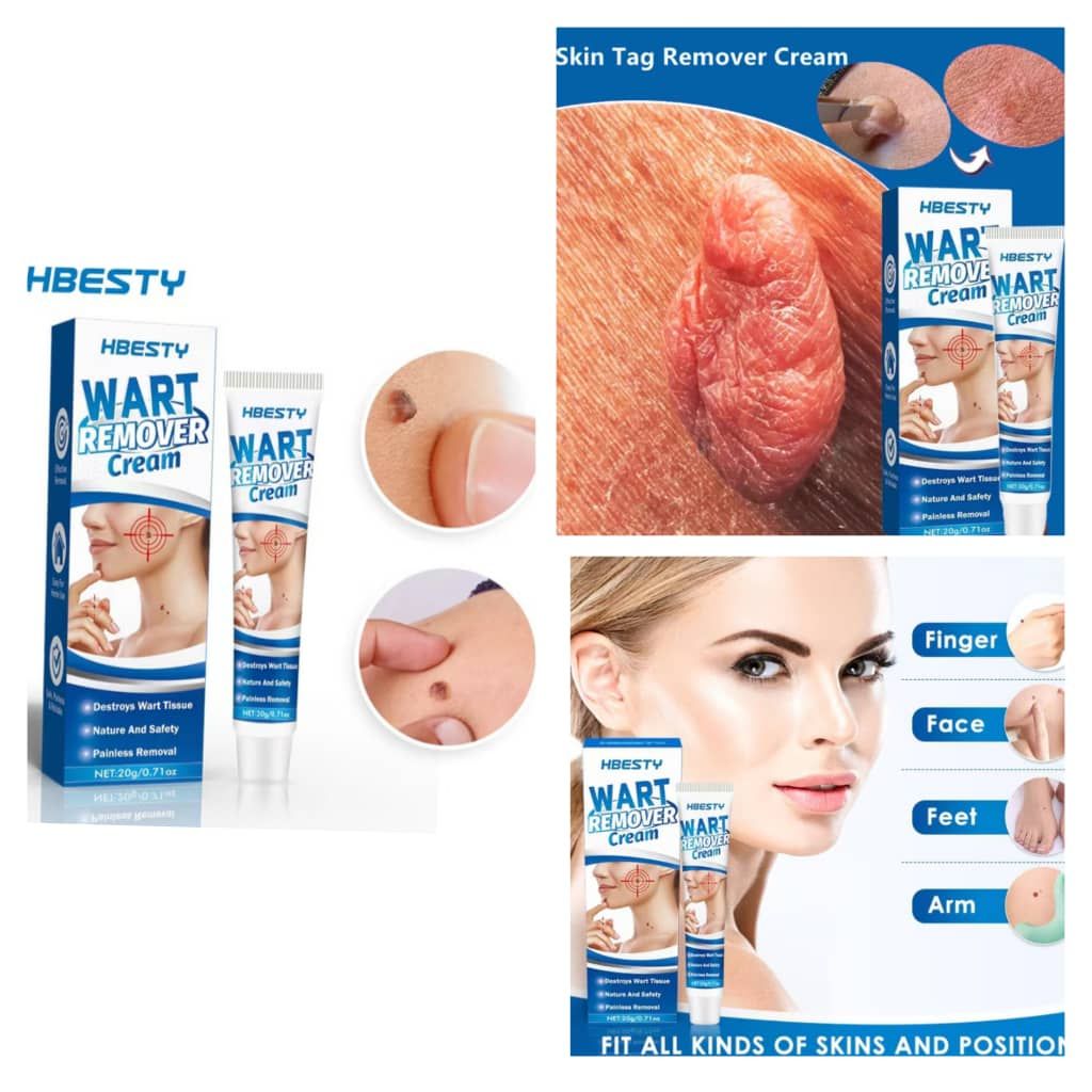 Effective Skin Tag, Mole ,Genital Wart, Removal Cream