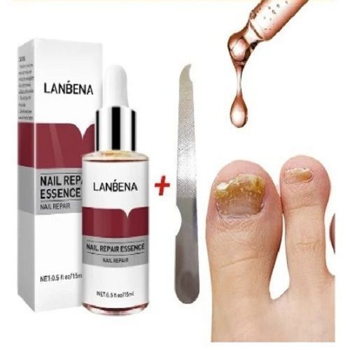 Nail Repair Essence And Anti-fungal Solution (15ml)