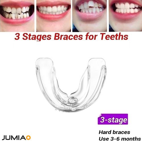3 Stages Teeth Corrector Bend Brace Aligner-3 Stage