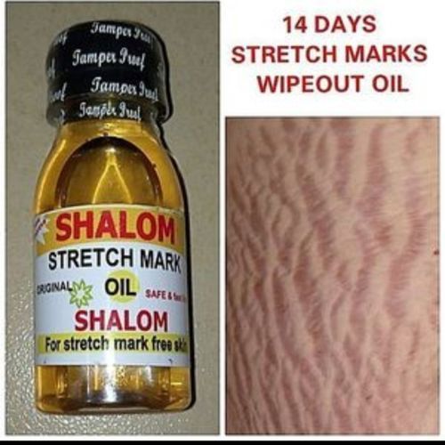 Stretch Marks Removal Oil