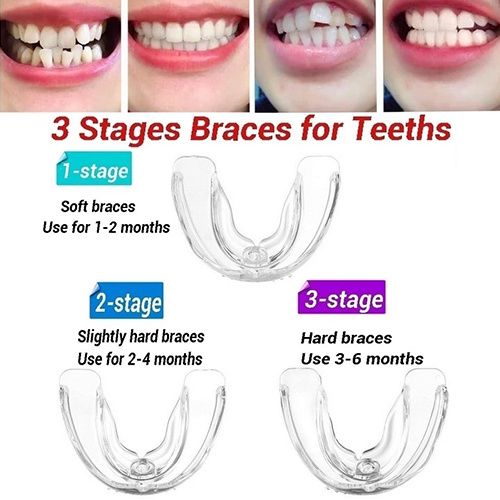 3 Stages Teeth Corrector Bend Brace Aligner