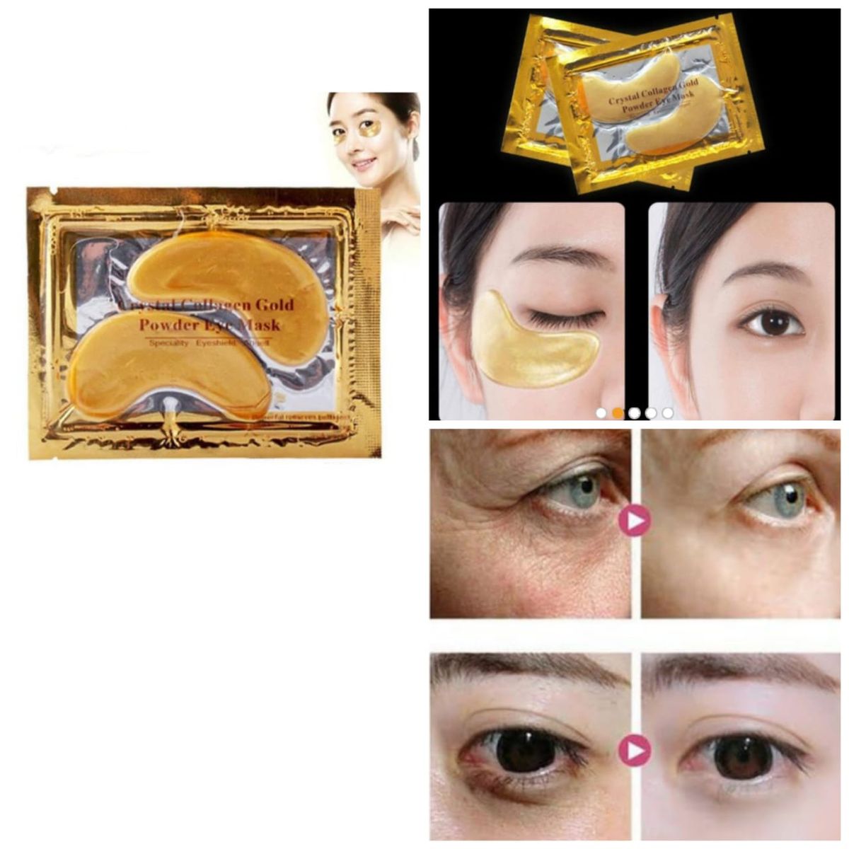 Anti- Aging, Dark Circle, Wrinkle, Puffy Eye Removal