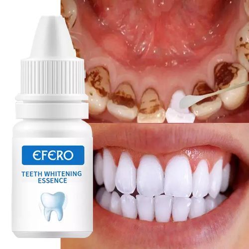 Efero Teeth Whitener 1pc