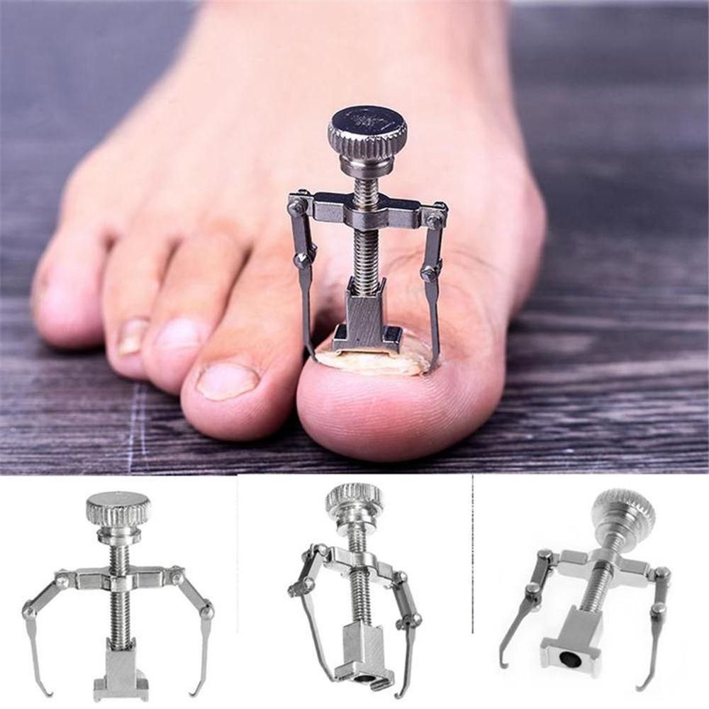 Ingrown Toenails Correction Pedicure Foot Toe Nail Care Straightening Clip Tools