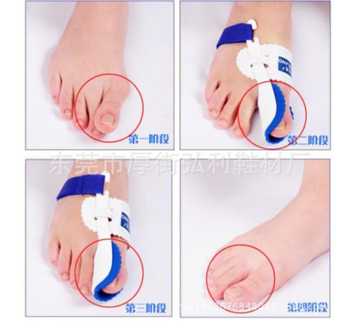 Big Toe Bunion Corrector Fraction Toe Straightener Hallux Valgus Straightener Bunion