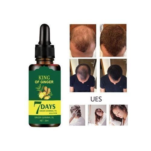 King Of Ginger-7Days Ginger Hair Solution Nutrient