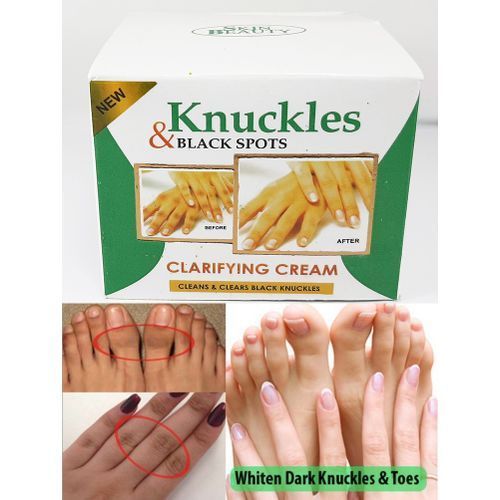Fast Effective Knuckles And Dark Spot Removal Cream!!