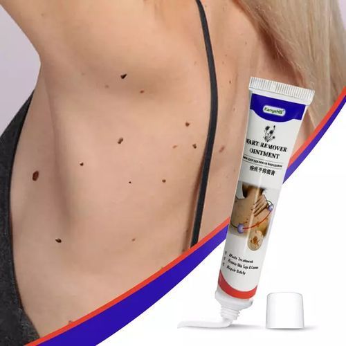 OUHOE Fast Natural Effective Skin Tag, Mole ,Genital Wart, Removal Cream