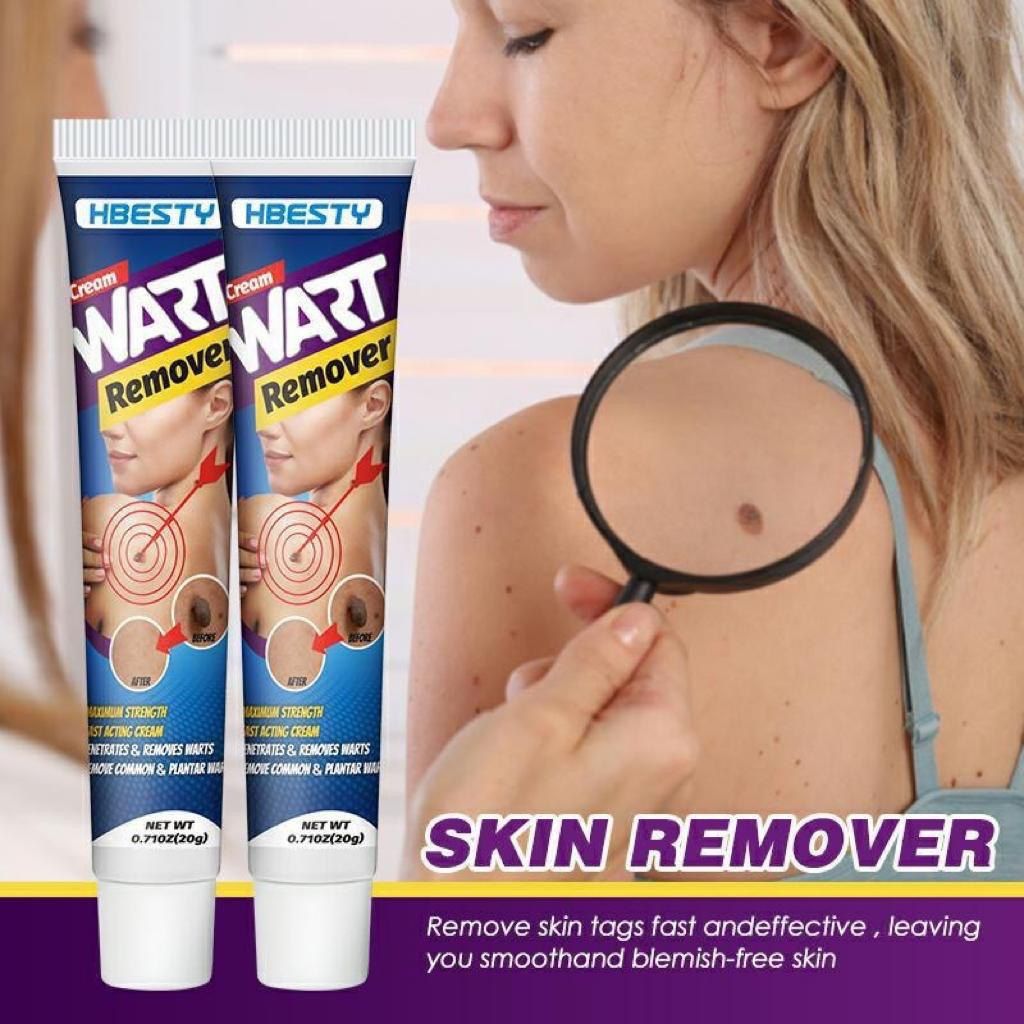 Fast Acting Herbal Wart Removal Ointment Cream