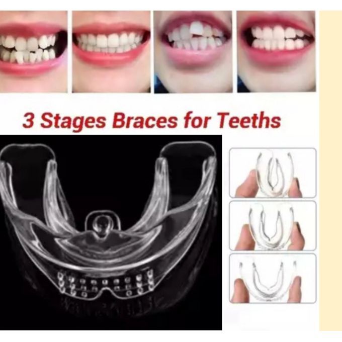 3 Stages Tooth Orthodontic Brace Teeth Retainer Corrector Stage 1-3(3Piece)