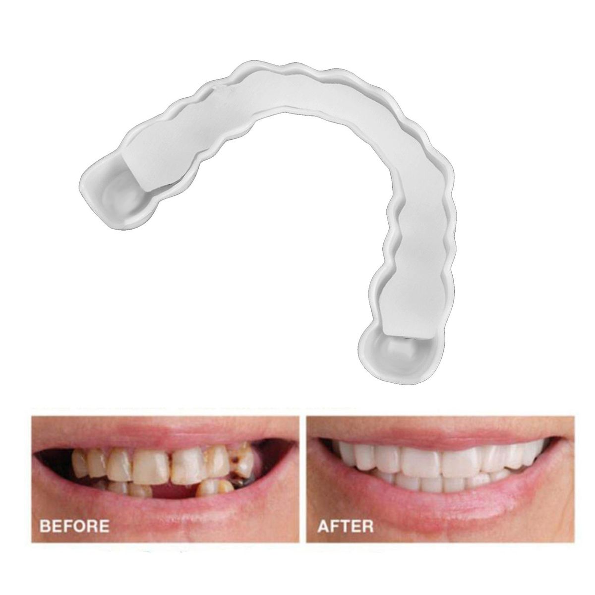 False Teeth Veneers Lower Dental Dentures Silicone   Tooth