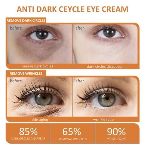 Powerful Vitamin C Eye Whitening Dark Circles Remove Fade Eye Bags Anti Wrinkle Serum