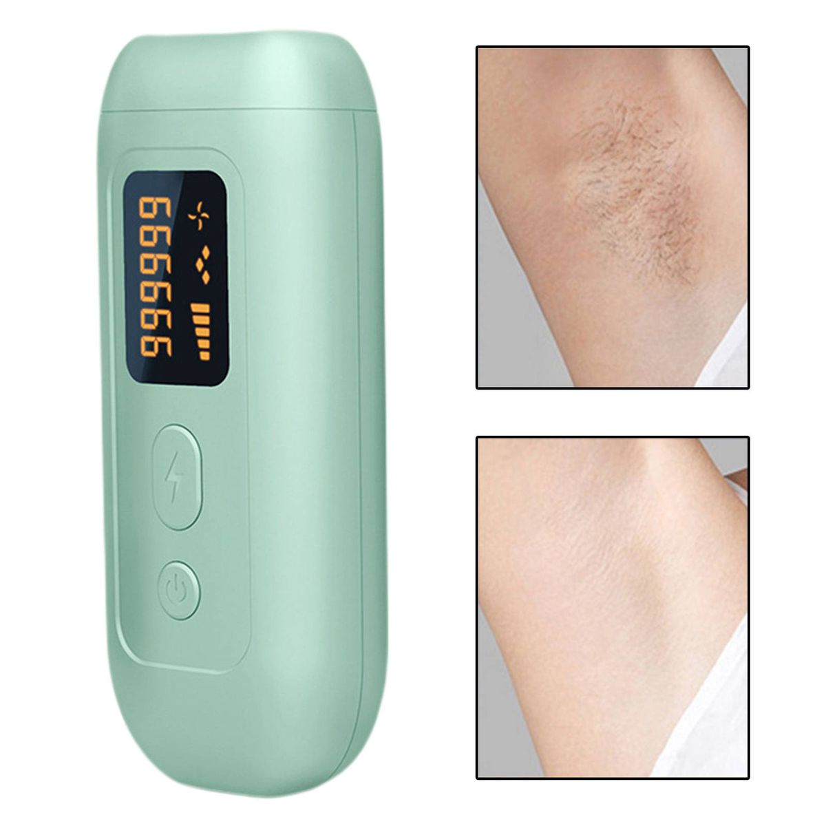 Laser Permanent Hair Removal Machine 990000 Flashes  US Green