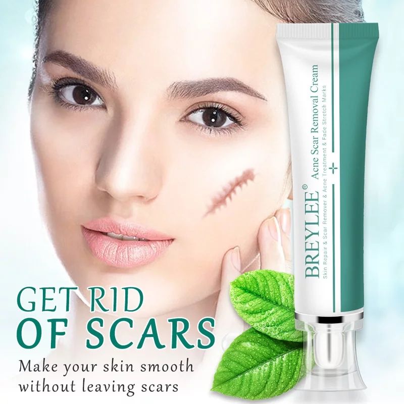 Breylee Acne Scar Removal Cream. - Skin Repair And Scar Remover / Acne Treatment / Stretch Mark Cream