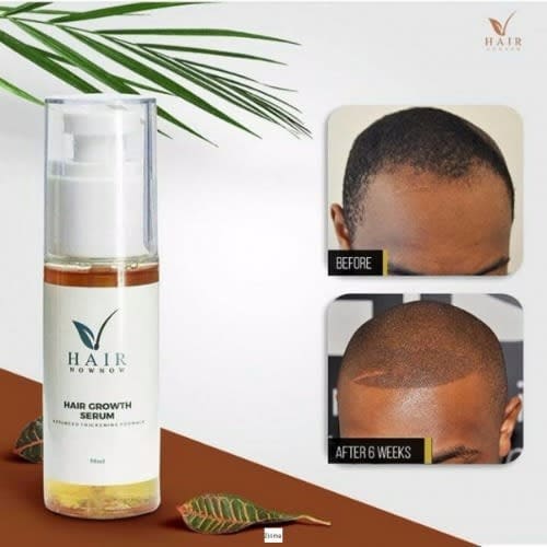 Hair Now Now Growth Serum - 50ml